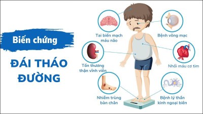 Trạm Y tế phường Chương Mỹ hưởng ứng ngày Thế giới phòng chống bệnh Đái tháo đường 14/11
